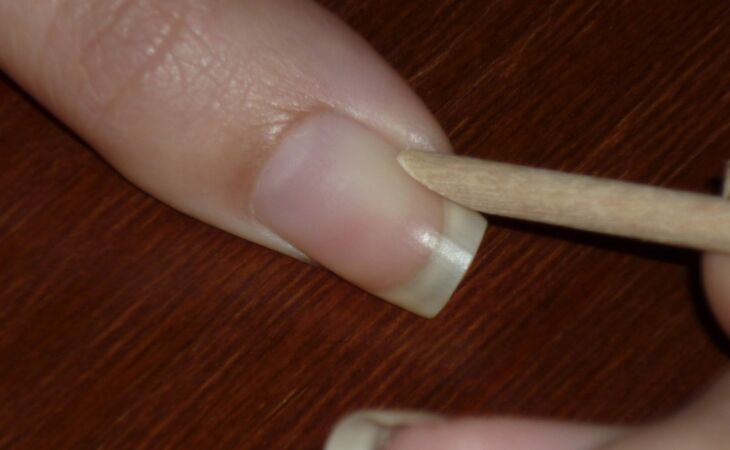 cuticole ughie