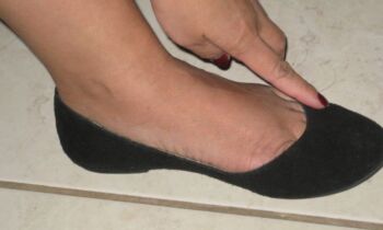 allargare scarpe strette