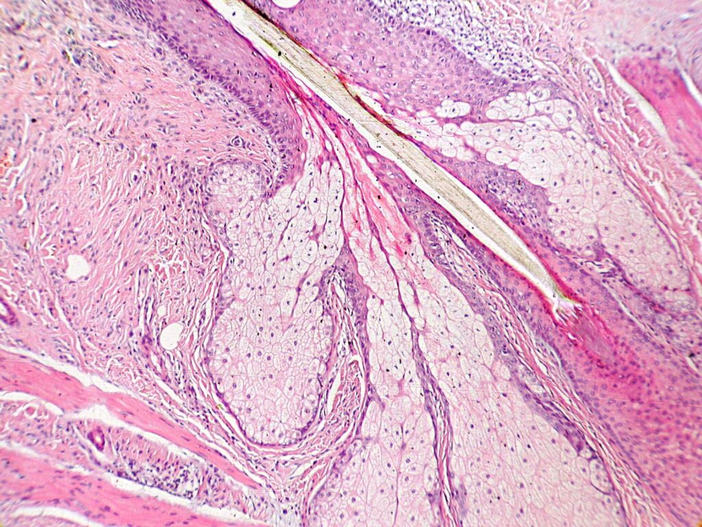 Al microscopio: le ghiandole sebacee che si aprono nel follicolo del pelo. Il poro che vediamo sul viso è lo sbocco di q